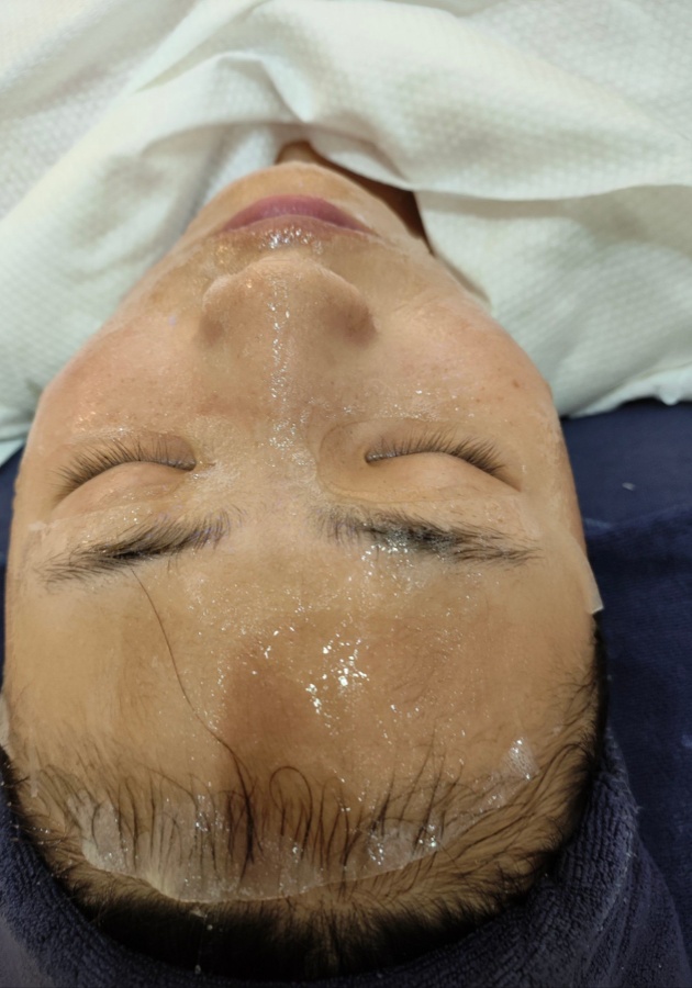 使用仙人掌护肤需注意事项